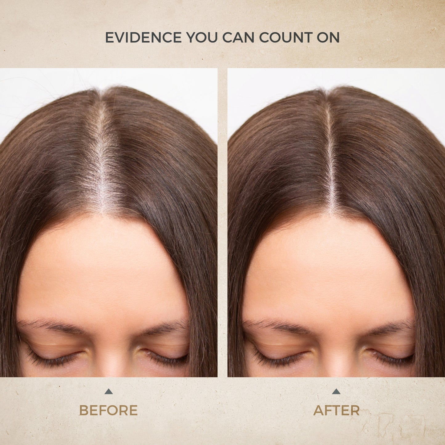 Anti_Dandruff_Shampoo_E-Commerce_Slides_05